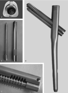 A-Trapezoidal-shape-of-proximal-nail-B-C-Integrated-screws-showing-track-on-larger